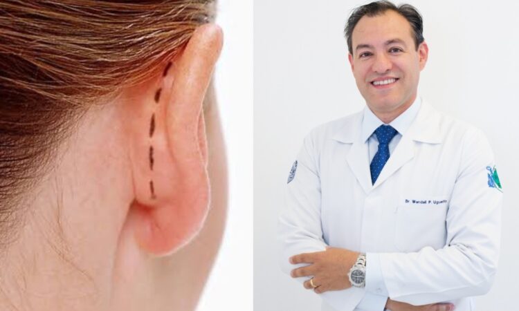 Otoplastia: Dr. Wendell Uguetto explica procedimento para correção de orelhas